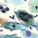 Δοκιμασία οξικού οξέως